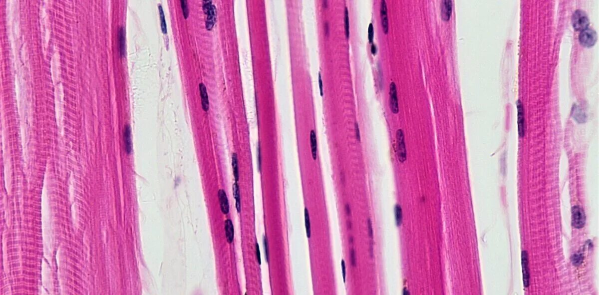 Волокна скелетных мышц под микроскопом их. Skeletal muscle под микроскопом. мышечная ткань под микроскопом. скелетная мышечная ткань. скелетные мышцы под микроскопом.