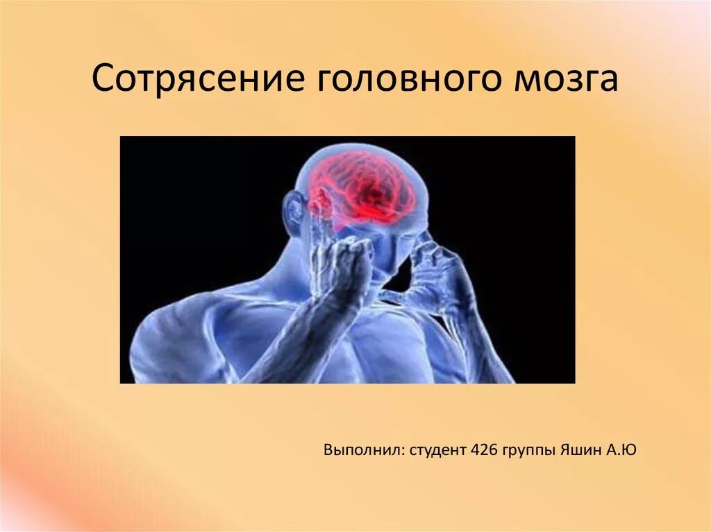 Сотрясение 2. Сотрясение головного мозга. Сотрясение головного м. Сотрясени еголовоного мозга. Сотрясение головного мозга презентация.