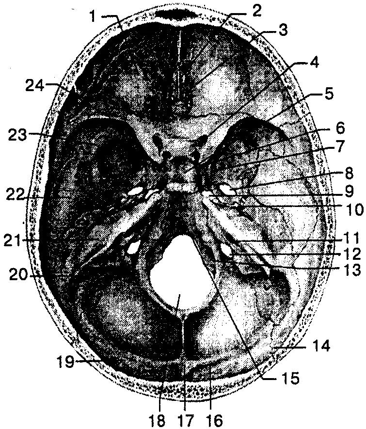 Внутреннее основание черепа анатомия. Основание черепа анатомия Черепные ямки. Черепные ямки внутреннего основания черепа. Черепные ямки анатомия внутреннее основание черепа. Мозговое основание черепа