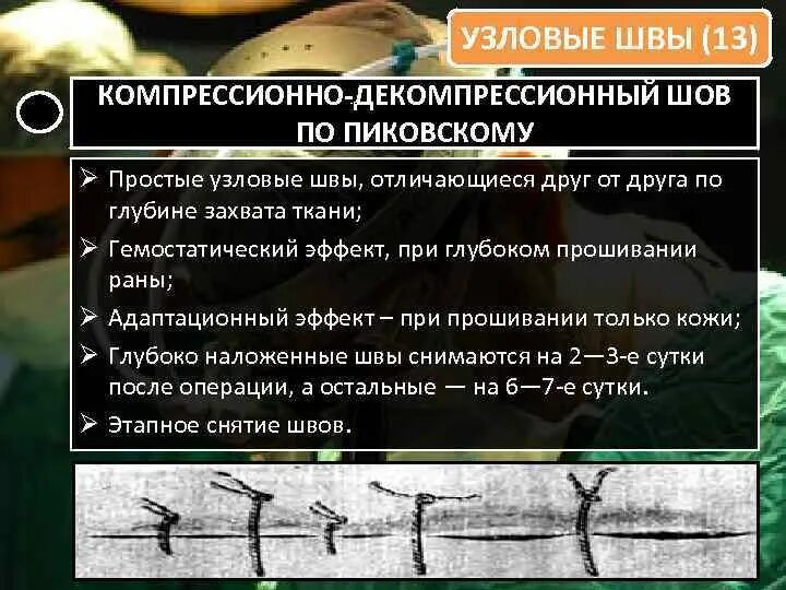 Узловой нетоксический зоб классификация. Узловой это какой. Простой узловой шов хирургия. Узловой зоб этиология и патогенез. Простой узловой шов хирургия.
