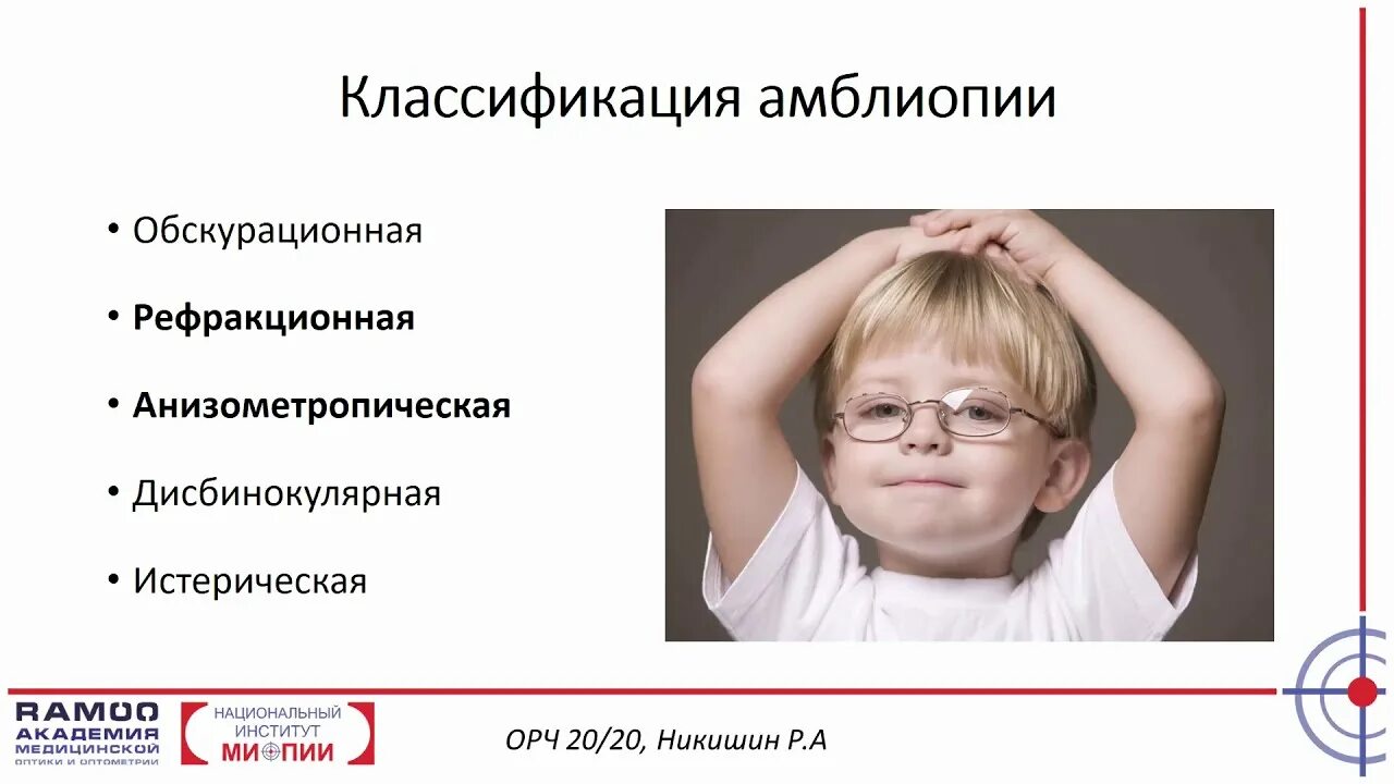 Операция лечения амблиопии у взрослых. Истерическая амблиопия. обскурационной амблиопии. амблиопия классификация. рефракционная амблиопия.
