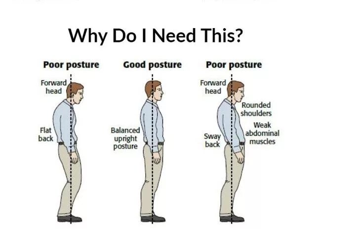 Standing upright. Poor posture. sway back осанка. upright posture. military-grade posture.