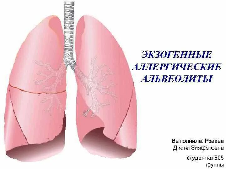 Токсико аллергический альвеолит кт. Гиперчувствительный альвеолит кт. Экзогенные аллергические альвеолиты. Экзогенный альвеолит кт.