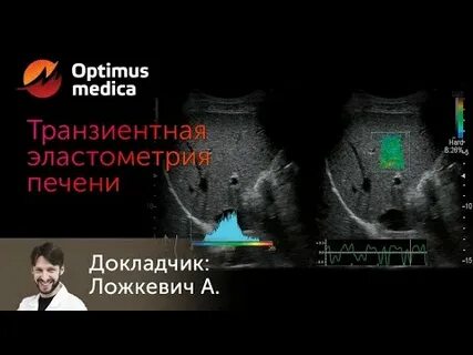 Где сделать эластометрию печени в нижнем новгороде