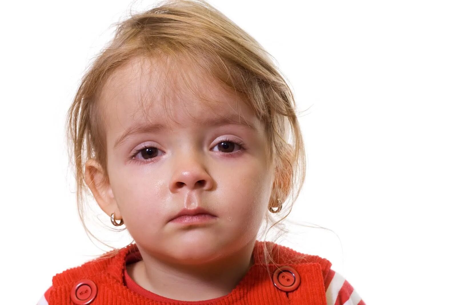 Конъюнктивит ребенка 6 лет. Аденовирусный конъюнктивит. Дети с больными глазками.