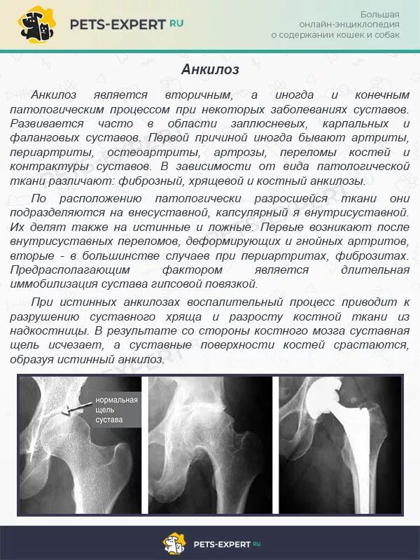 Анкилоз тазобедренного сустава. Анкилоз плечевого сустава рентген. анкилоз коленного сустава рентгенограмма. анкилозирование тазобедренного сустава. костный анкилоз коленного сустава.