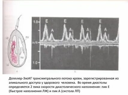 Пика е