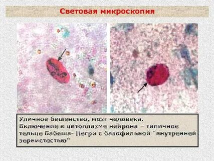 Тельца бабеша
