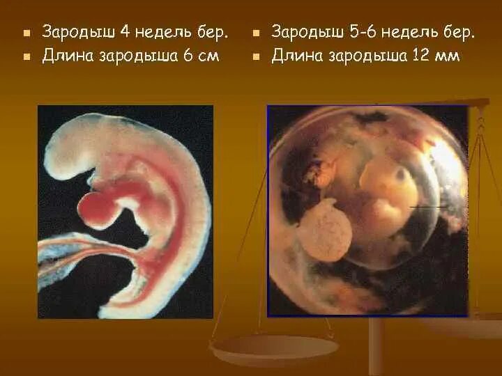 Зародыш в 3 недели беременности размер. Эмбрион 5,5 5 неделя берем.