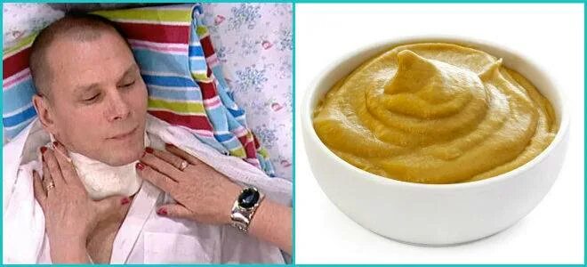 Компресс при ангине на горло. Полуспиртовый компресс. Согревающий компресс на шею. Компресс при ангине на горло. Компресс из творога от кашля.