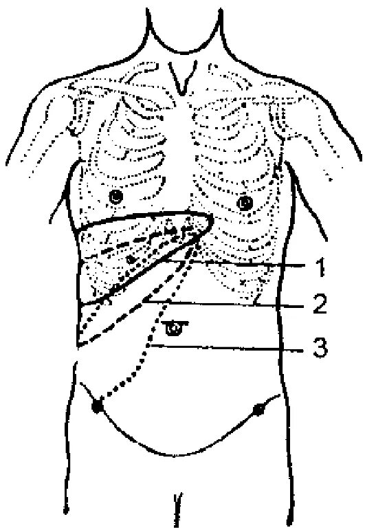 Печень по краю реберной дуги. Границы печени. Проекция печени. Проекция желчного пузыря на переднюю брюшную стенку. Границы печени по курлову схема.