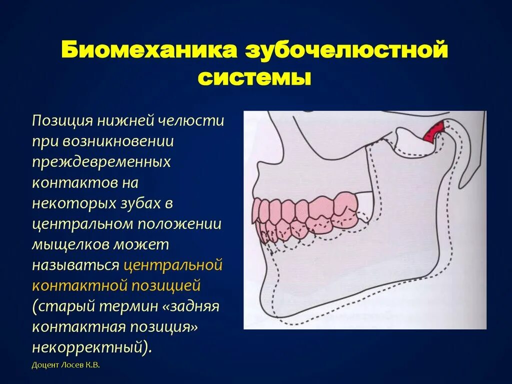 Анатомия зубочелюстной системы. Биомеханика височно-нижнечелюстного сустава презентация. биомеханика зубочелюстной системы. височно нижнечелюстной сустав жидкость.