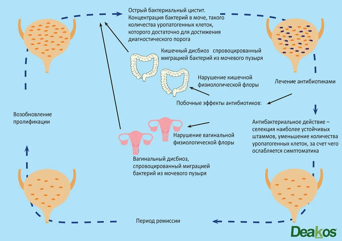 Лечение мочевого пузыря у мужчин лекарства. Острый бактериальный цистит. Бактерии в мочевом пузыре. Микроорганизмы вызывающие цистит. Бактерии в моче при цистите у женщин.