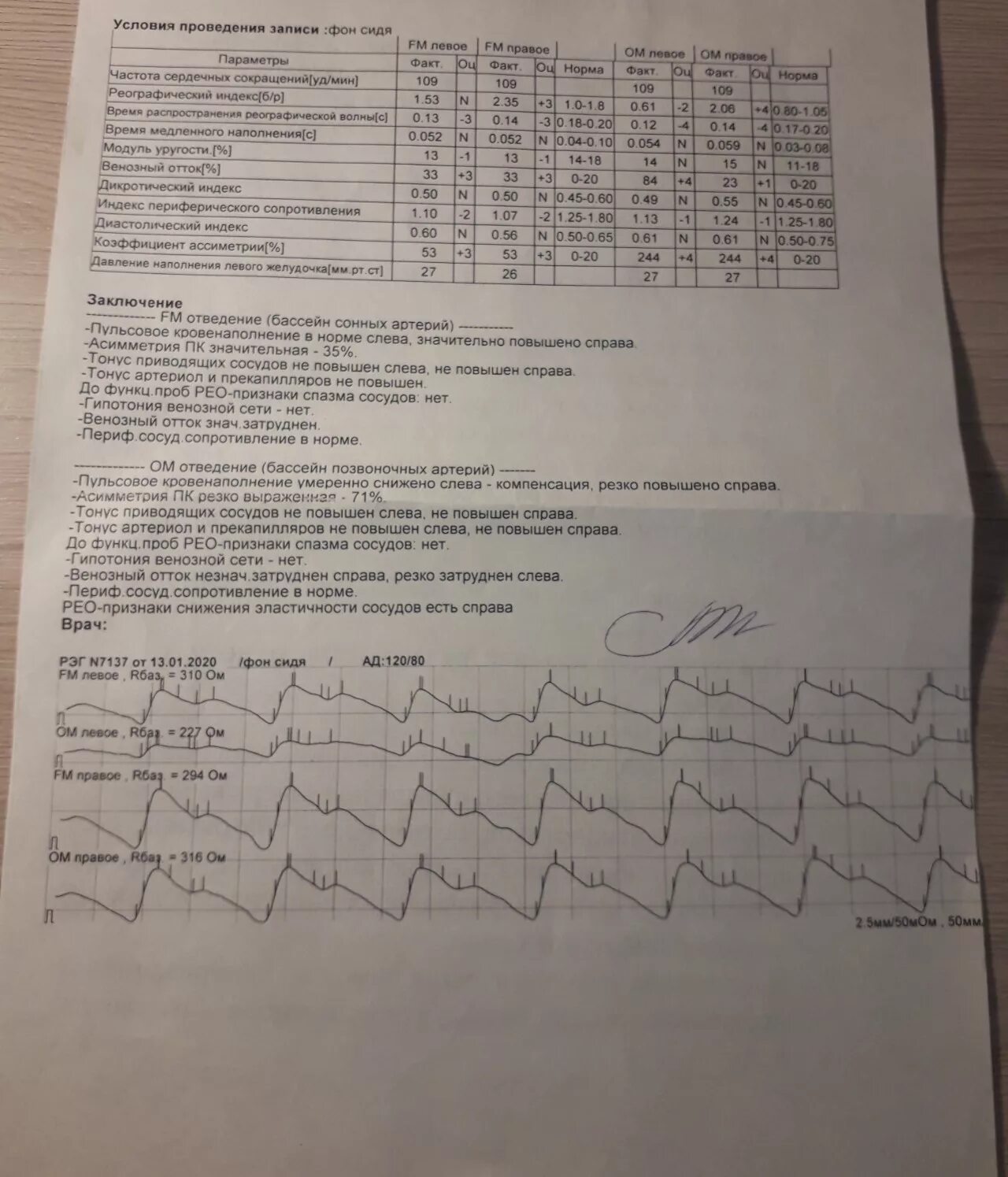 Что показывает рэг головы. Рэг и ээг. Реоэнцефалография сосудов головного мозга нормы. Электроэнцефалография головного мозга (ээг). Норма рэг у взрослых таблица.