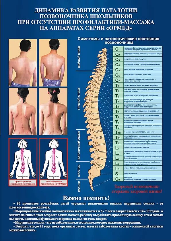 Что означает поясницы. Позвоночник. Состояние позвоночника. Искривление позвоночника. Описание позвоночника.