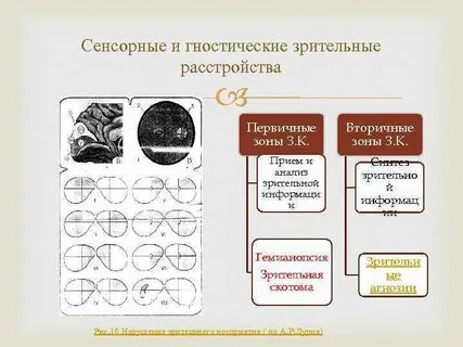 Сенсорные нарушения зрительной системы