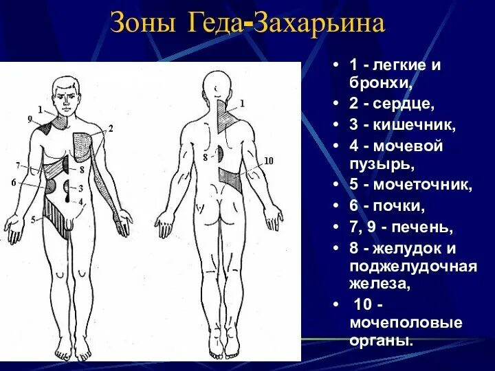 Зоны кожной гиперестезии захарьина геда. Отраженная боль в зоне захарьина-геда. Захарьина. Рефлекторные зоны захарьина-геда. Захарьина.