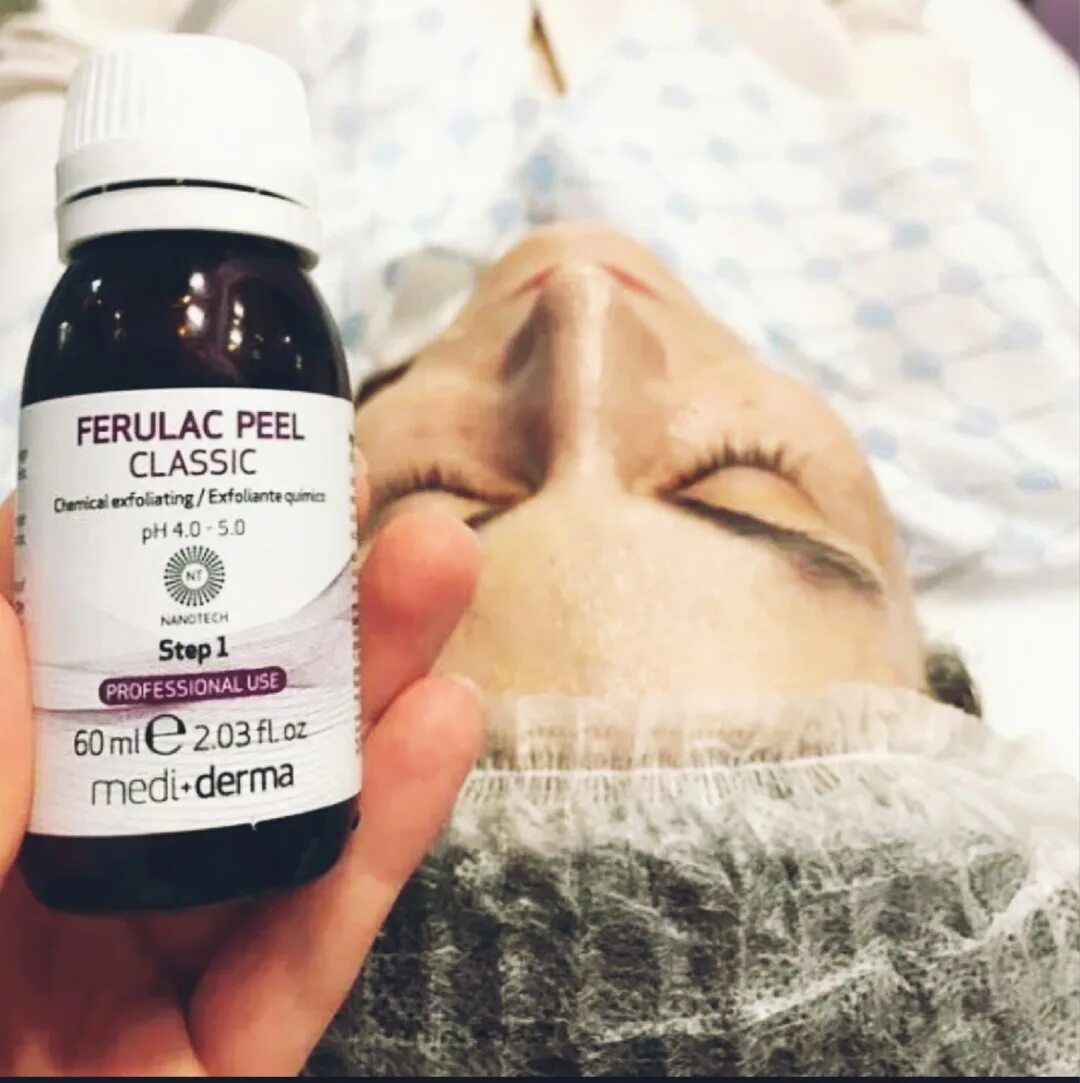 Феруловый пилинг для лица что это такое. Феруловый пилинг mediderma. ferulac classic mediderma пилинг. пилинг ferulac peel classic. миндальный пилинг mediderma.