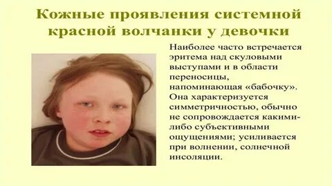 Проявление системных