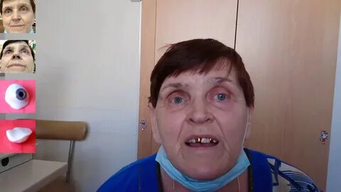 Центр глазного протезирования 14
