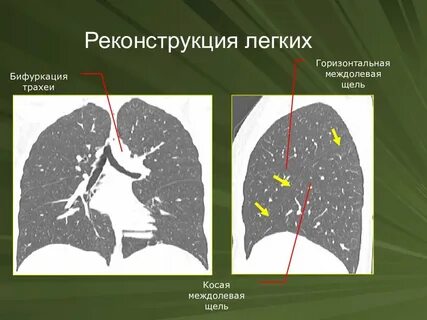 Горизонтальная щель
