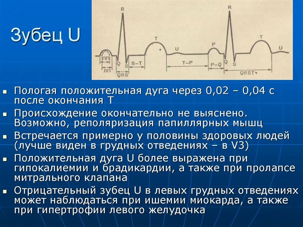 Нарастание зубца. Зубец u на ЭКГ отражает. Появление зубца u на ЭКГ. Зубец QRST на ЭКГ. ЭКГ зубцы.