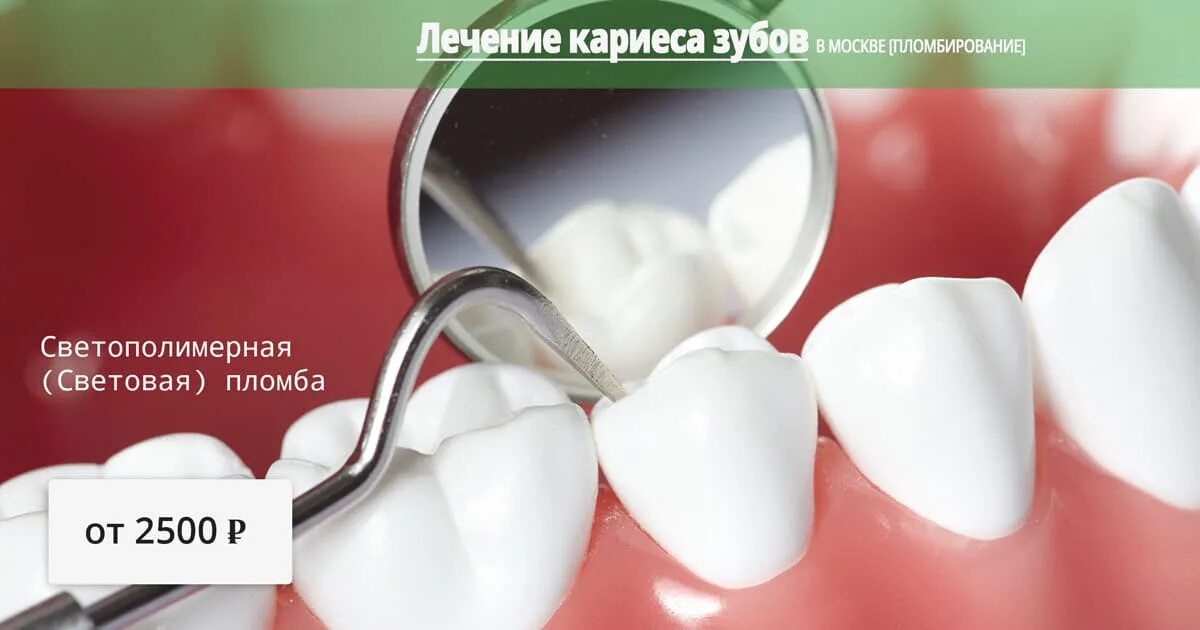 Гарантия платной пломбы