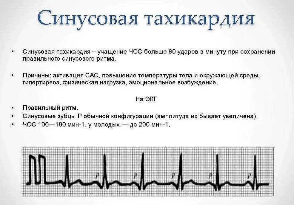 Сердцебиение повышено причины