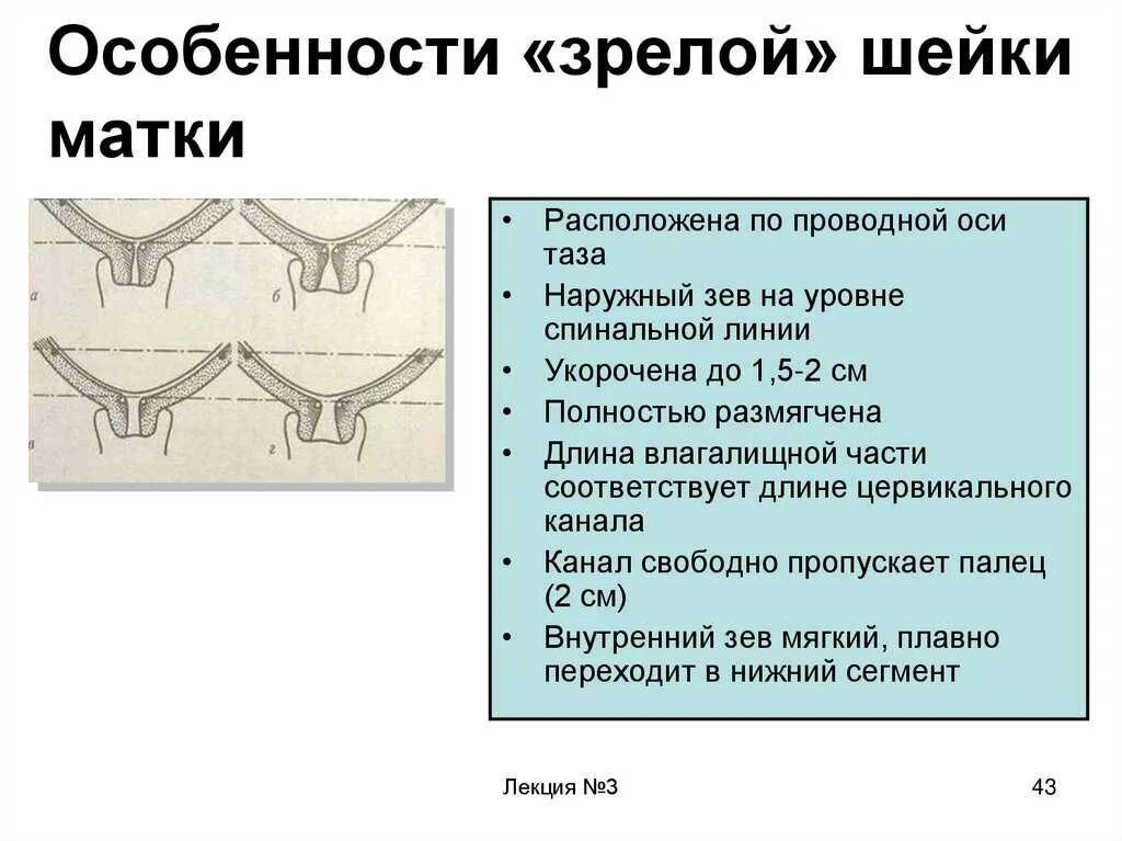 Лекарство для раскрытия шейки матки. Шейка готова к родам.