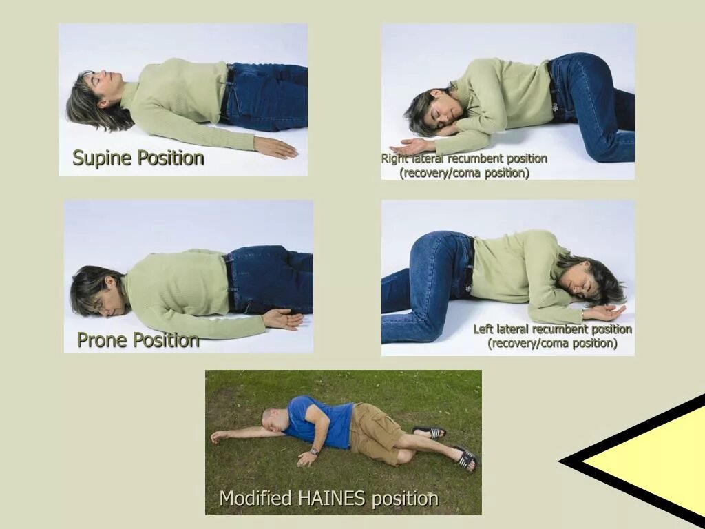 Improved position. Recovery position. supine position. lateral recumbent position. prone позиция.