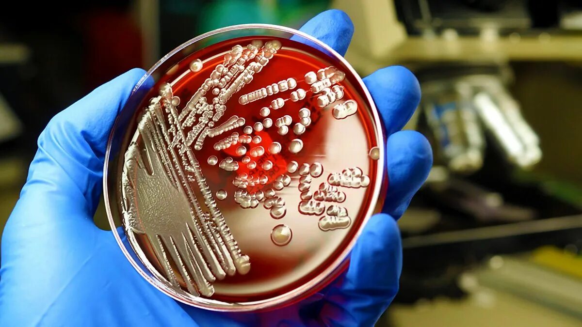 Staphylococcus e coli