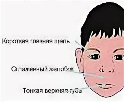 Фас диагноз