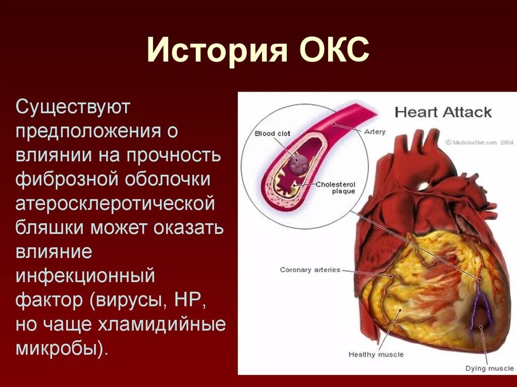 Коронарные осложнения. Острый коронарный синдром. Острый коронарный синдр. Остро коронарный синдром. Острый коронарный синдром (Окс).