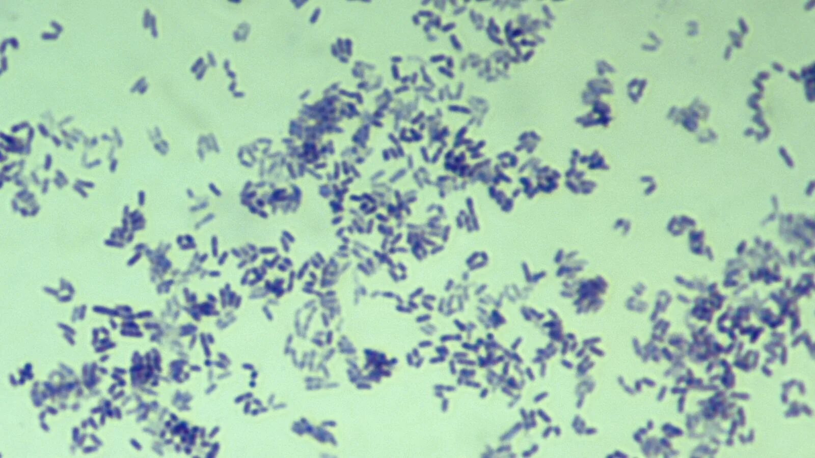 Corynebacterium spp в мазке у мужчин
