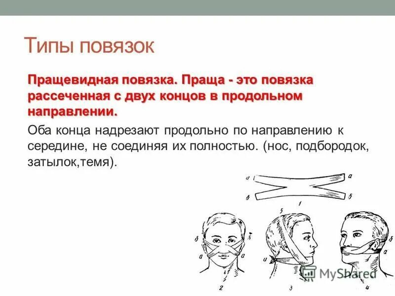 Повязка на голову размеры. Пращевидная повязка на подбородок техника. Пращевидная повязка на затылок. Плющевидная повязка. Пращевидная повязка на глаз.