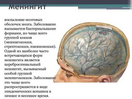 Менингит причины и последствия