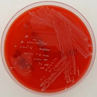 Corynebacterium