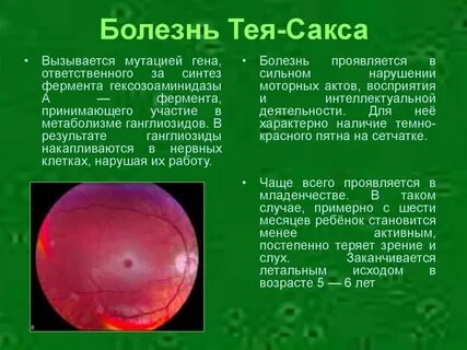 Тея сакса