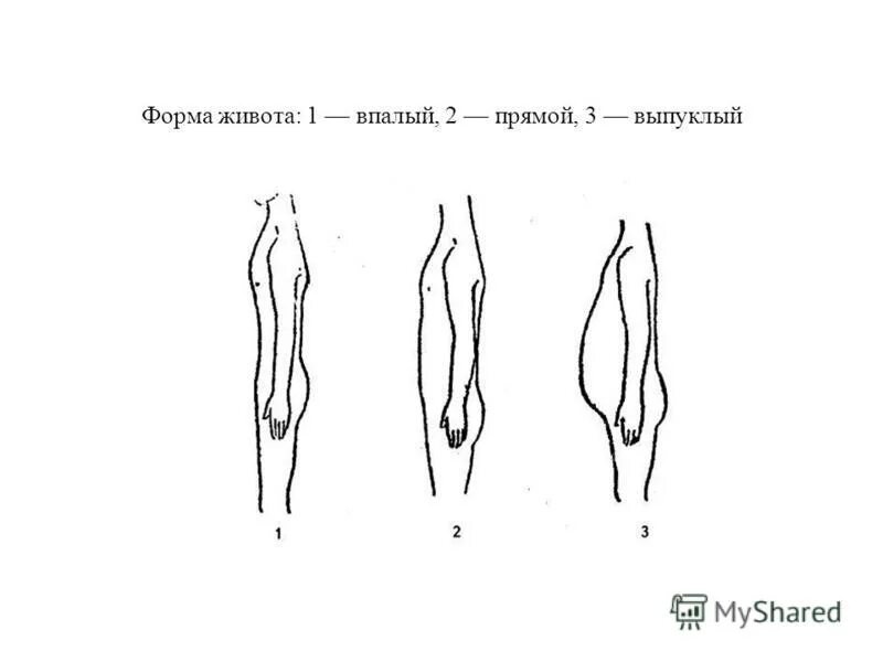 разные формы живота у женщин. форма живота. индивидуальные и возрастные различия форм живота. форма живота беременной девочкой. форма живота.