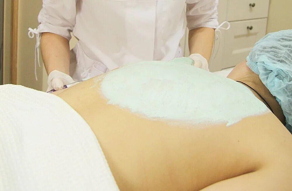 чистка кожи спины