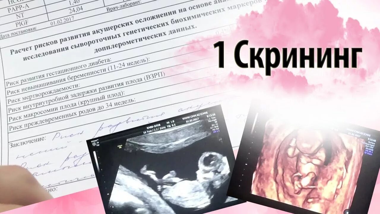 УЗИ скрининг. УЗИ 12 недель. УЗИ 12-13 недель беременности. УЗИ 11-12 недель беременности. 13 неделя даты