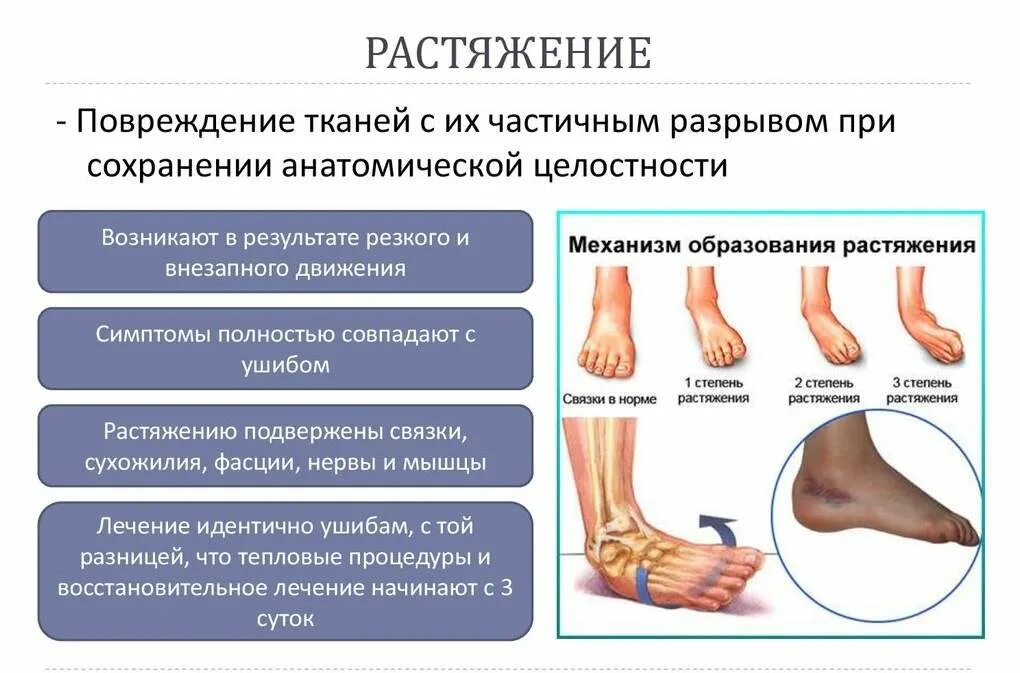 Что значит растяжение. При растяжении голеностопного сустава. растяжение связок стопы. растяжение и разрыв связок.