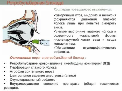 Блокада глаза