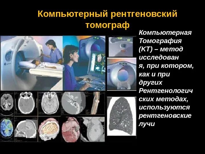 Насколько вредно кт. Метод компьютерной томографии. Спиральная рентгеновская компьютерная томография. Рентгеновский компьютерный томограф. Принцип компьютерной томографии.