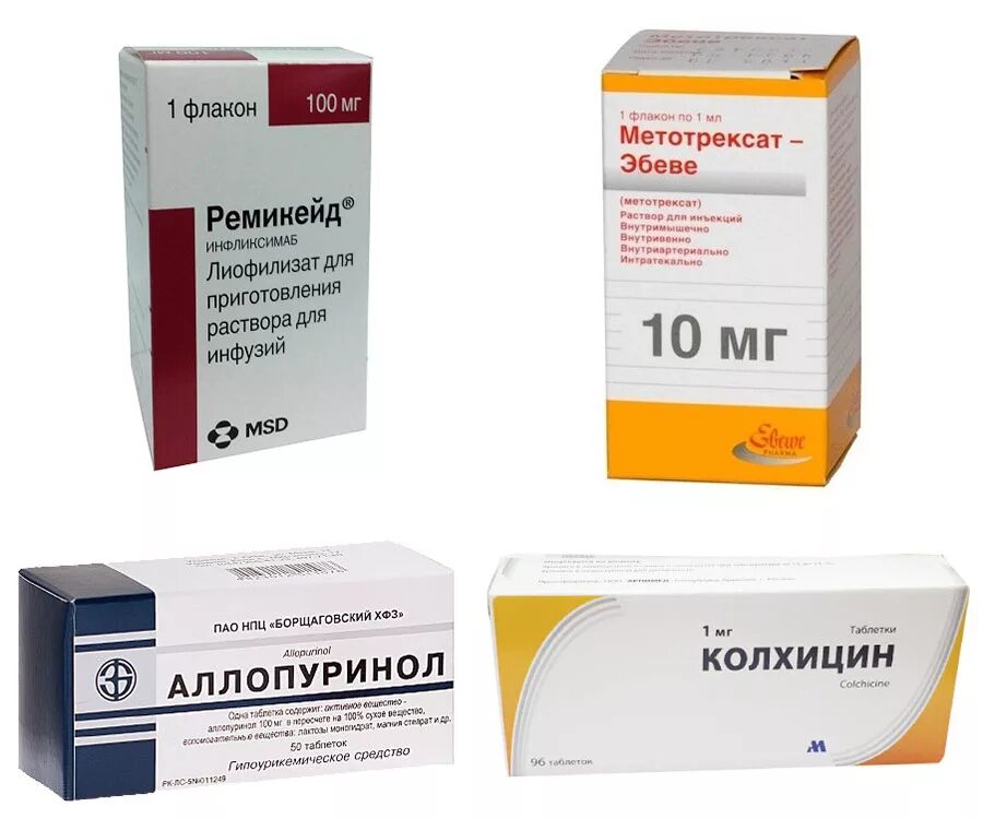 Отек голеностопного сустава: причины, лечение, симптомы при разных патологиях