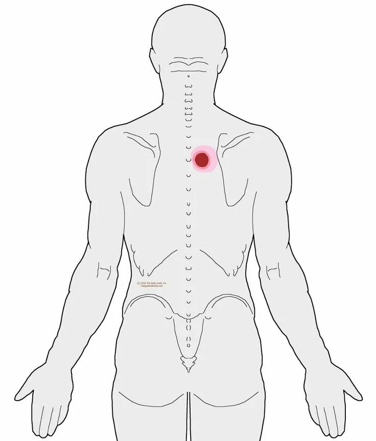 Точка между лопатками. Болит между лопатками. Спина болит между лопатками. Точка на спине между лопатками. Back between
