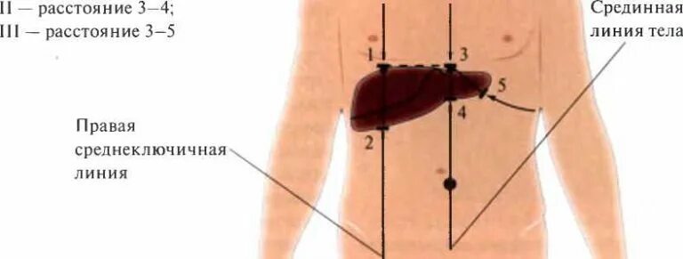 Печень по курлову у детей. Методика определения размеров печени по курлову. Перкуссия печени границы в норме. Границы печени у детей перкуссия. Перкуссию границ печени по курлову ребенку 5 лет..
