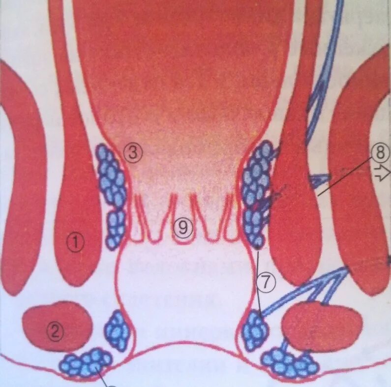 Перианальный геморроидальный тромбоз. Геморроидальные вены прямой кишки.