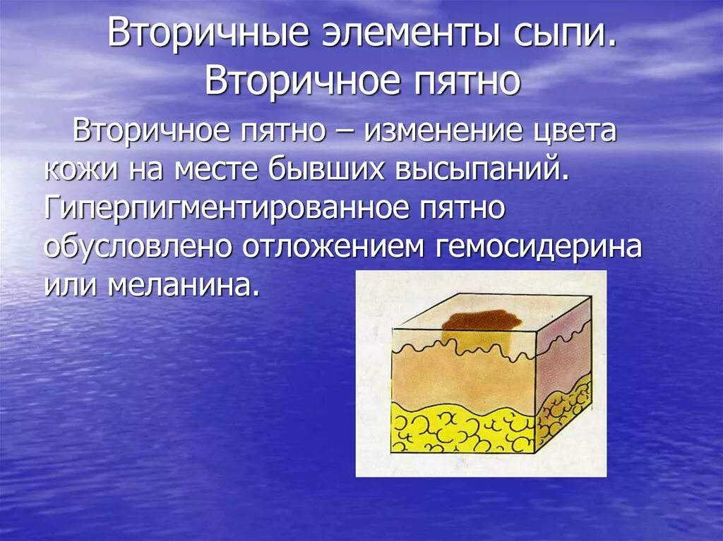 Вторичные элементы поражения