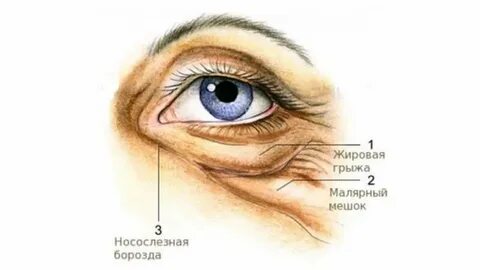 Как замаскировать малярные мешки